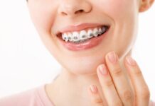 Precision Orthodontics and Modern Braces Solutions for Confident Smiles